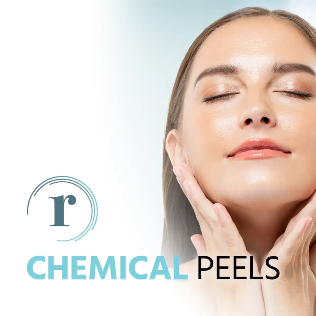 Chemical Peel near me